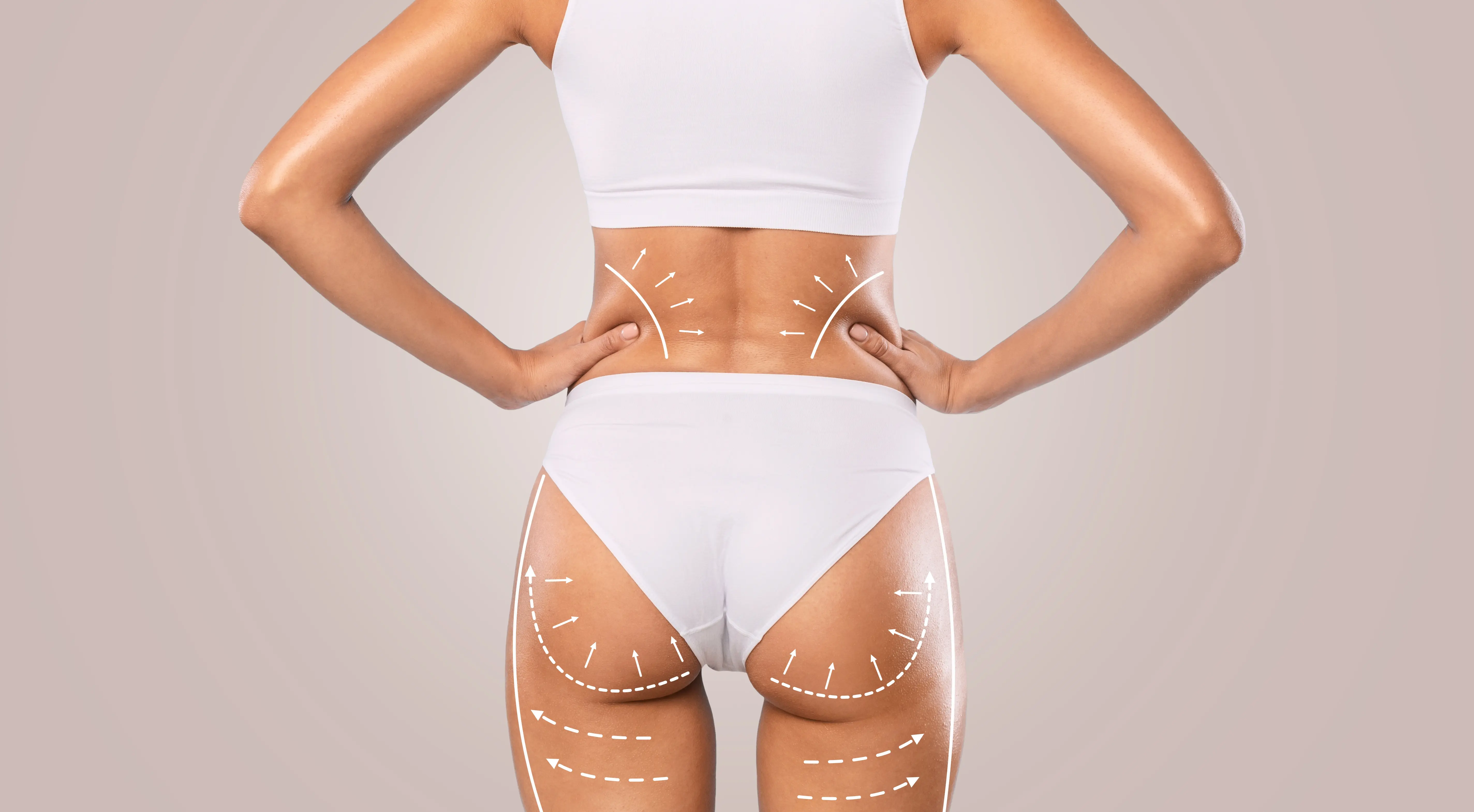 Thigh and Buttock Lift procedure
